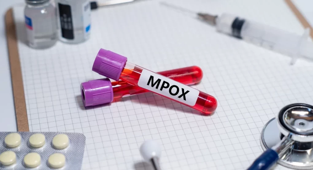 ΠΟΥ: Η mpox δεν είναι η νέα covid -Tι δήλωσε στέλεχος του Οργανισμού