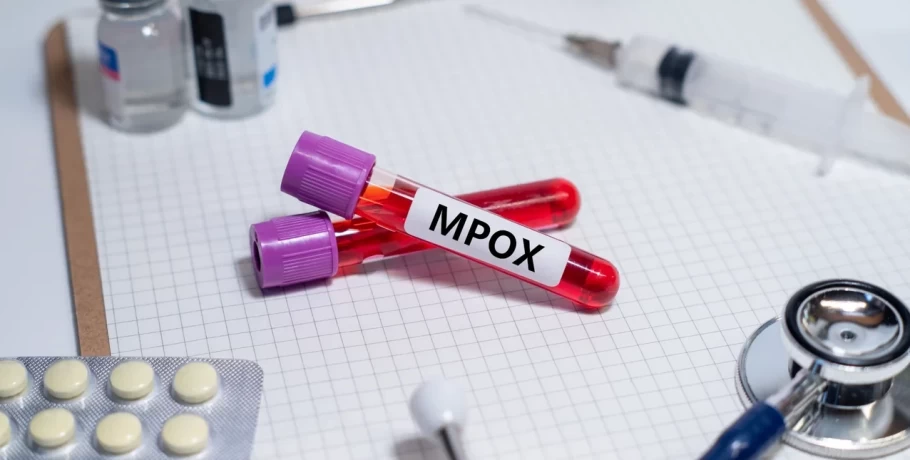 ΠΟΥ: Η mpox δεν είναι η νέα covid -Tι δήλωσε στέλεχος του Οργανισμού